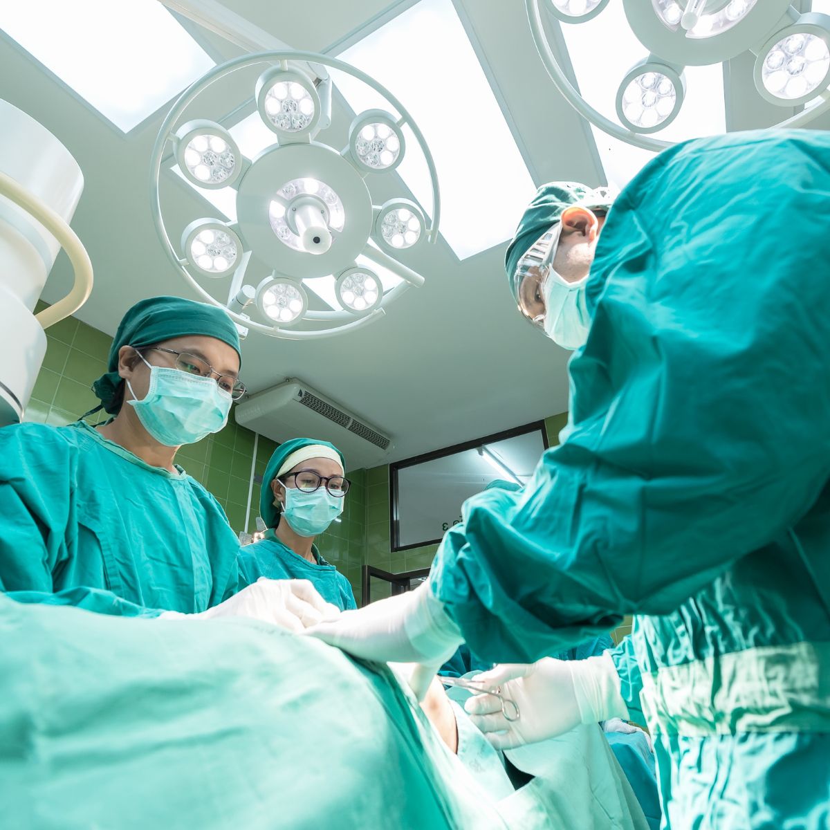 Como conseguir a cirurgia bariátrica pela Unimed?