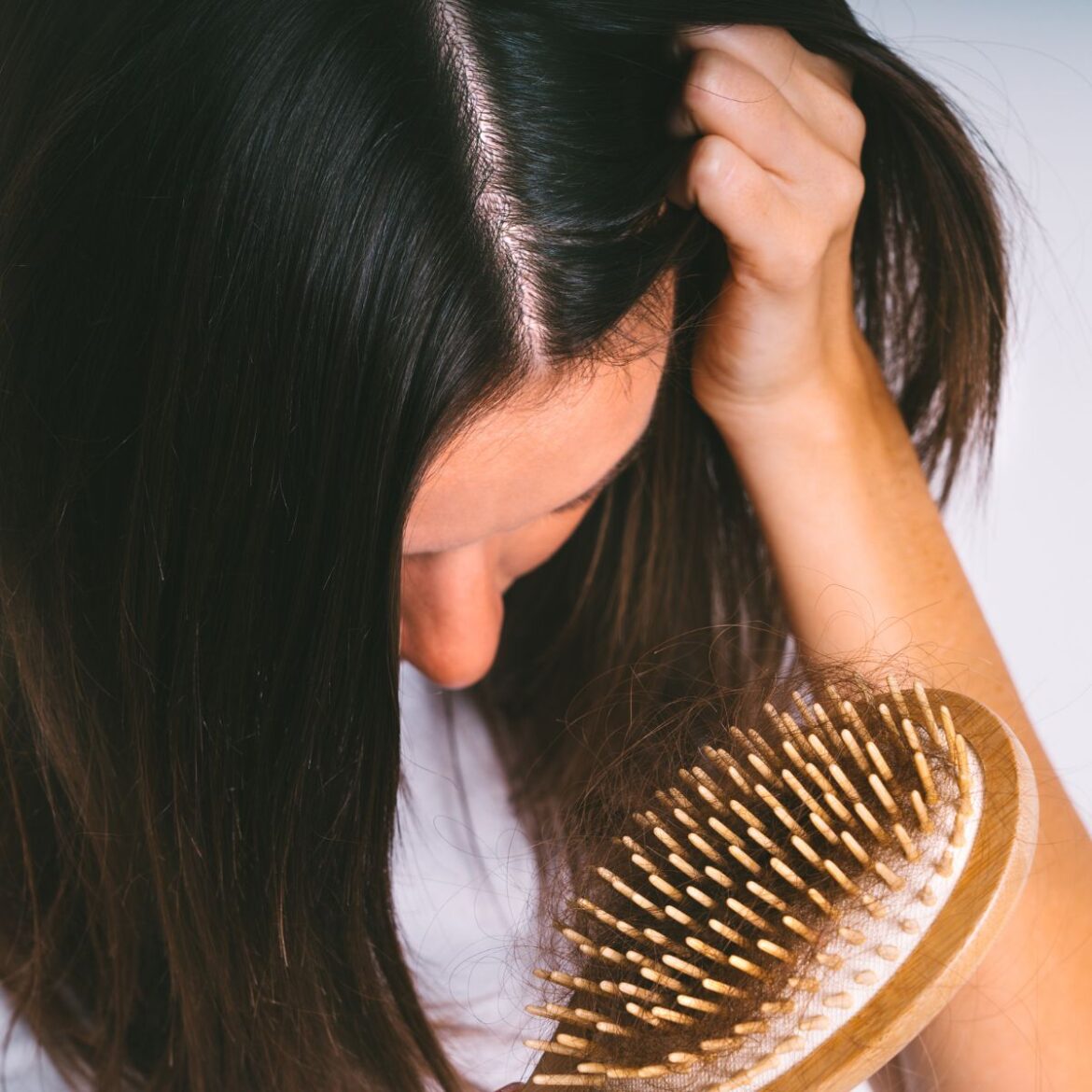 É possível emagrecer sem perder cabelo?